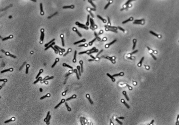 Prokaryotes