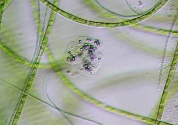 Protozoa